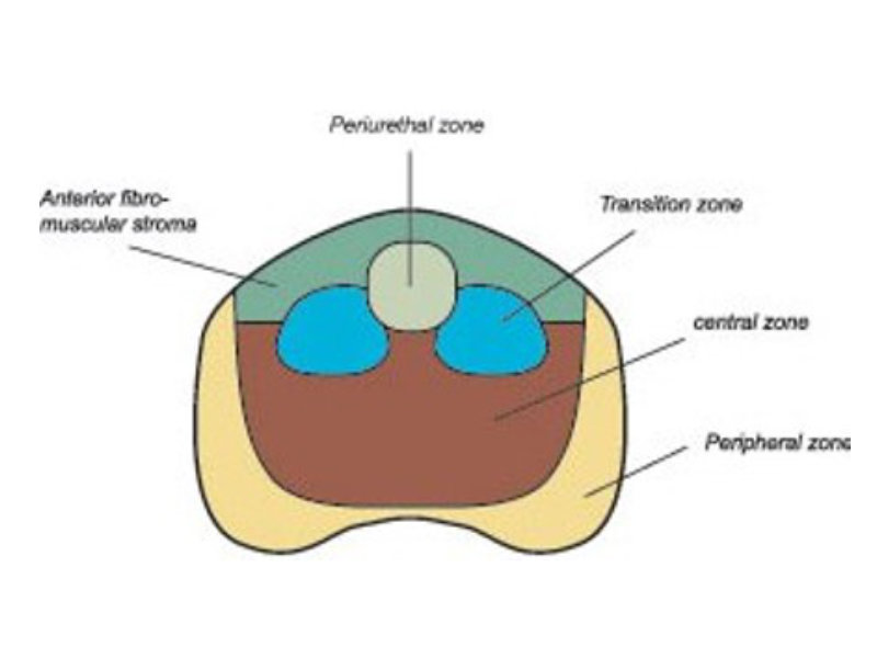 Схема простаты. Зоны предстательной железы на УЗИ. Переходная зона простаты. Периферическая зона предстательной железы. Зональная анатомия предстательной железы УЗИ.