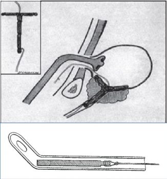 picture 43 picture 43